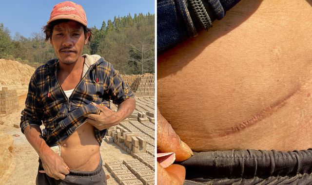 Nepal villagers duped into selling kidneys and told organ would regrow - now country faces new health crisis - Vimarsana News