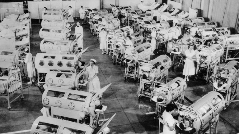 Nurse attend to a room full of polio patients in iron lung respirators. Rancho Los Amigos Respirator Center, Hondo, California in 1953
Pic:Alamy
