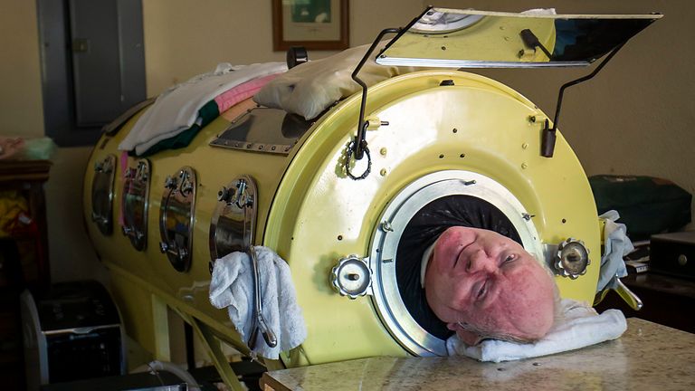 Paul Alexander looks out from inside his iron lung.
Pic: The Dallas Morning News/AP