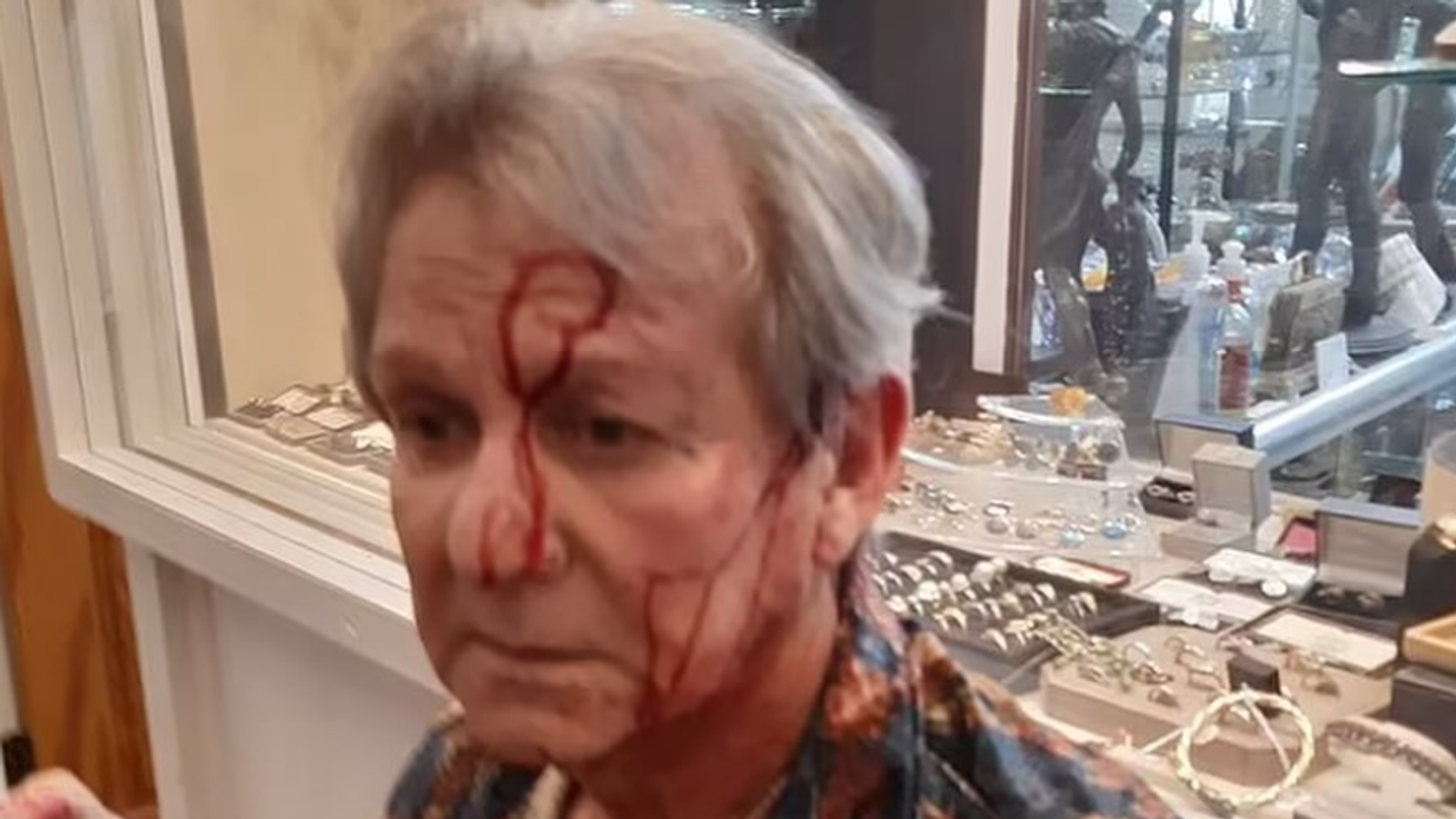 Celebrity antiques expert Ian Towning reveals injuries after hammer attack during robbery