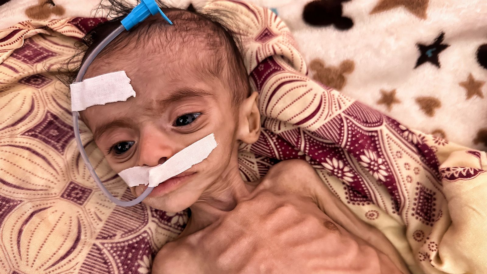 Babies are starving as Yemen teeters on brink of collapse - while ...