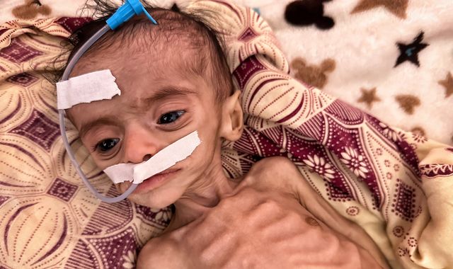 Yemen: How one of the world's worst humanitarian disasters is getting even worse - Vimarsana News