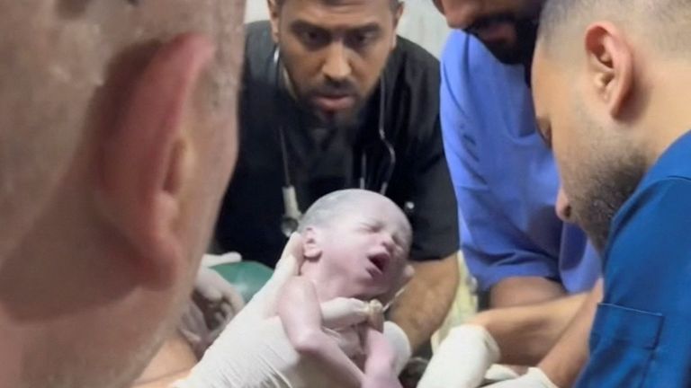 یک پزشک یک دختر تازه متولد شده فلسطینی را پس از زنده شدن زنده از شکم مادرش صابرین الشیخ (السقانی) که در حمله اسرائیل به همراه همسرش شکری و دخترش ملک کشته شد، در بحبوحه درگیری های ادامه دار بین خود نگه می دارد. اسرائیل و گروه اسلامگرای فلسطینی حماس، در بیمارستانی در رفح در جنوب نوار غزه، در این تصویر ثابت گرفته شده از ویدئو ضبط شده در 20 آوریل 2024. تلویزیون رویترز از طریق رویترز