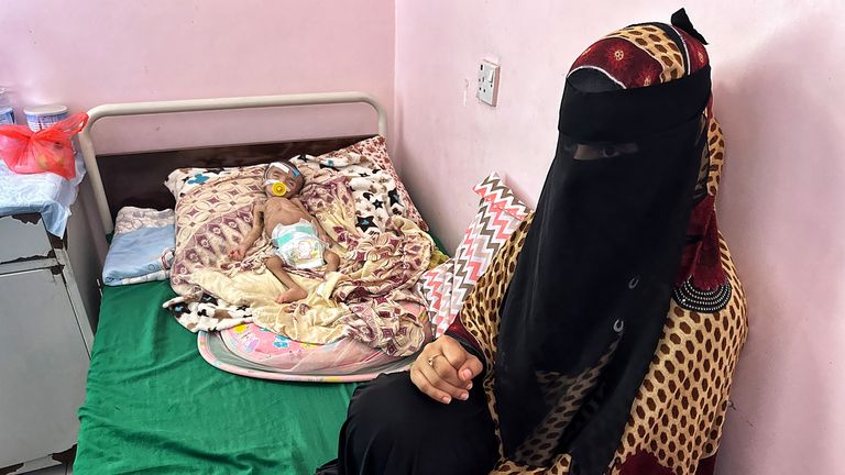 A mother and her baby in a Yemen hospital