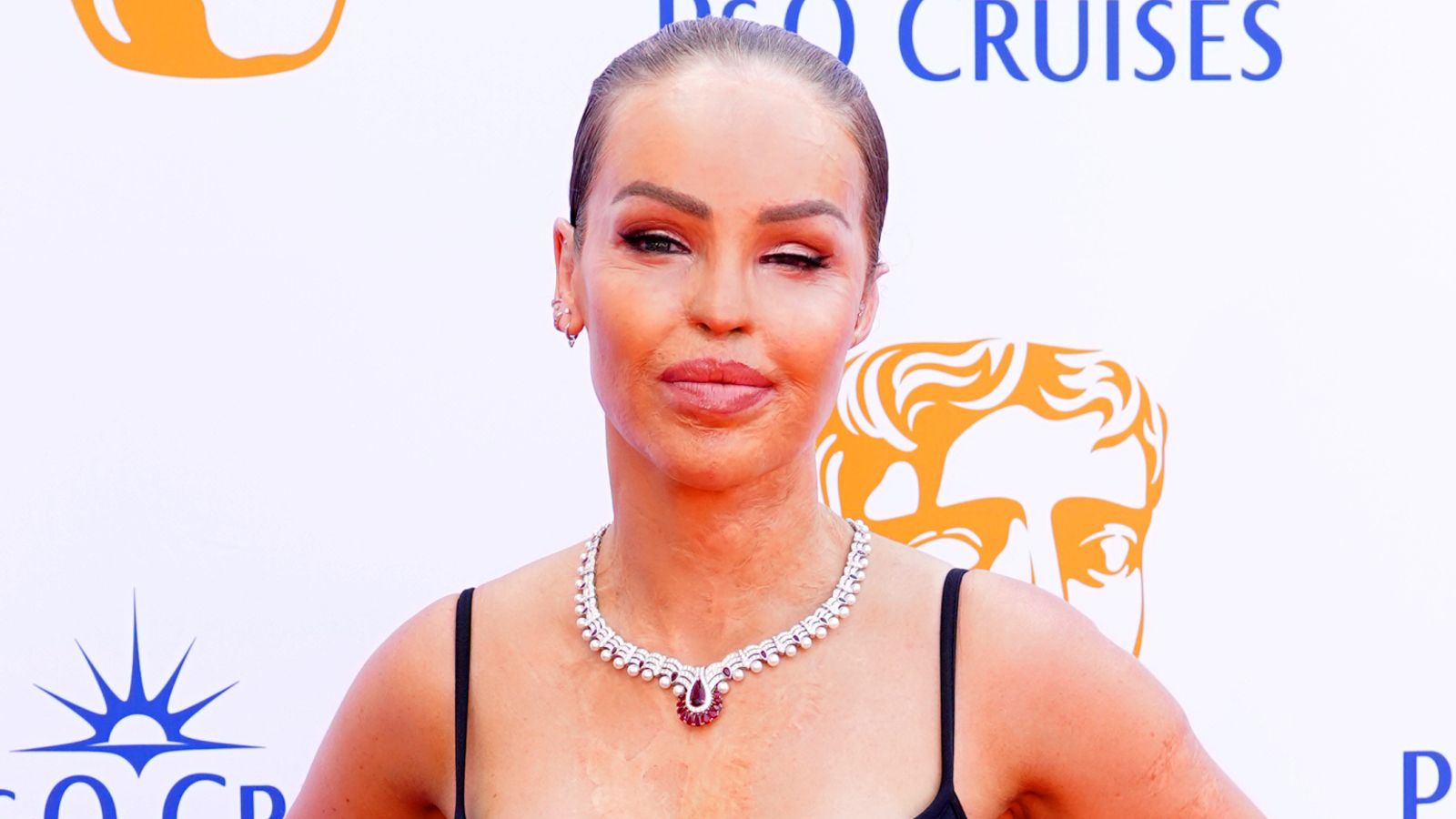 Katie Piper forced to pull out of ITV show for 'unexpected medical procedure'