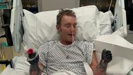 Craig Mackinlay in hospital before the amputation of his limbs Pic: Katalin Mackinlay