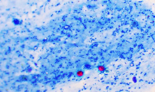 Brixham: Water disease outbreak may last a week - and infected could be ill for up to a month, expert warns - Vimarsana News