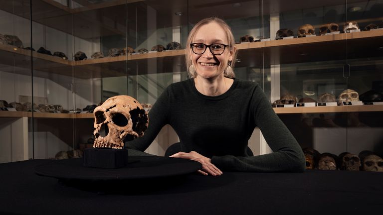 Dr Emma Pomeroy with the skull of Shanidar Z. Pic: PA