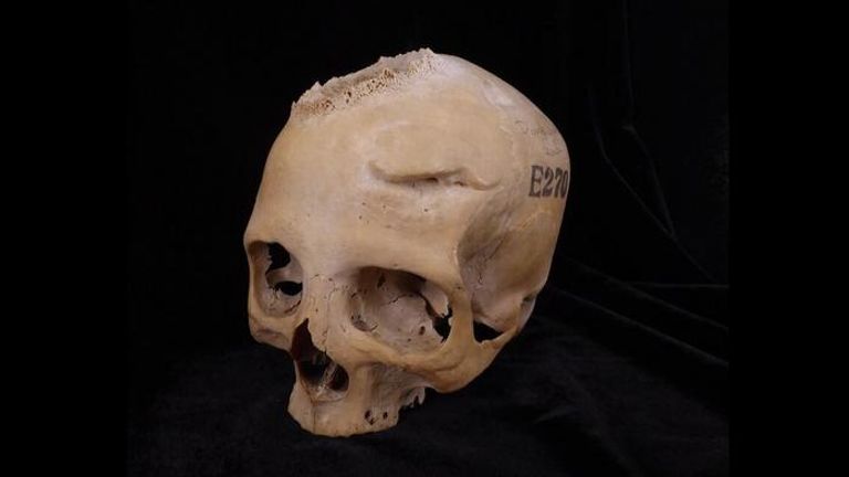The female skull studied by the scientists. Pic: Tondini, Isidro, Camaros, 2024.