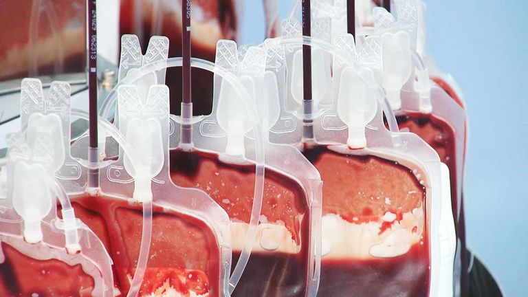 Blood donations are now routinely screened for pathogens