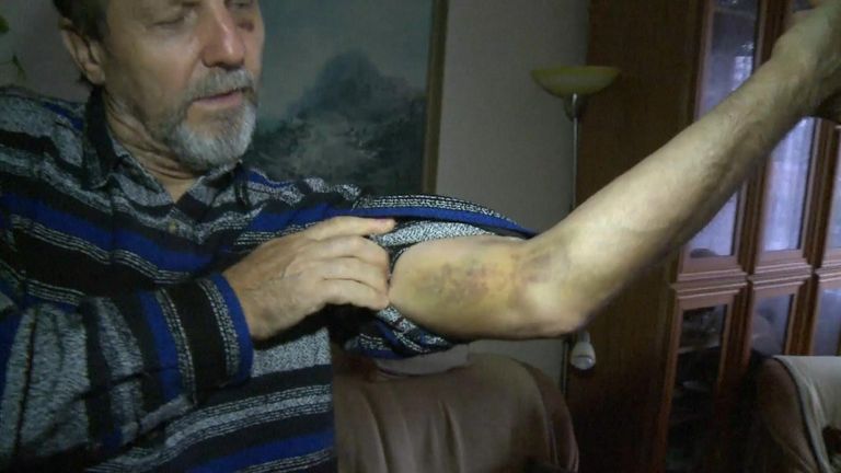 Juraj Cintula was beaten while working as a security guard.
Pic: ENEX