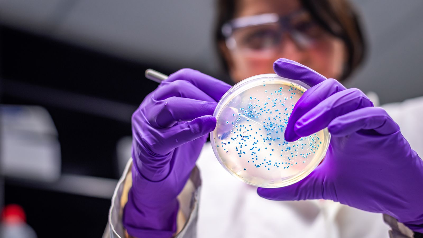 Избухване на E.coli: Какви са предупредителните признаци за инфекция?