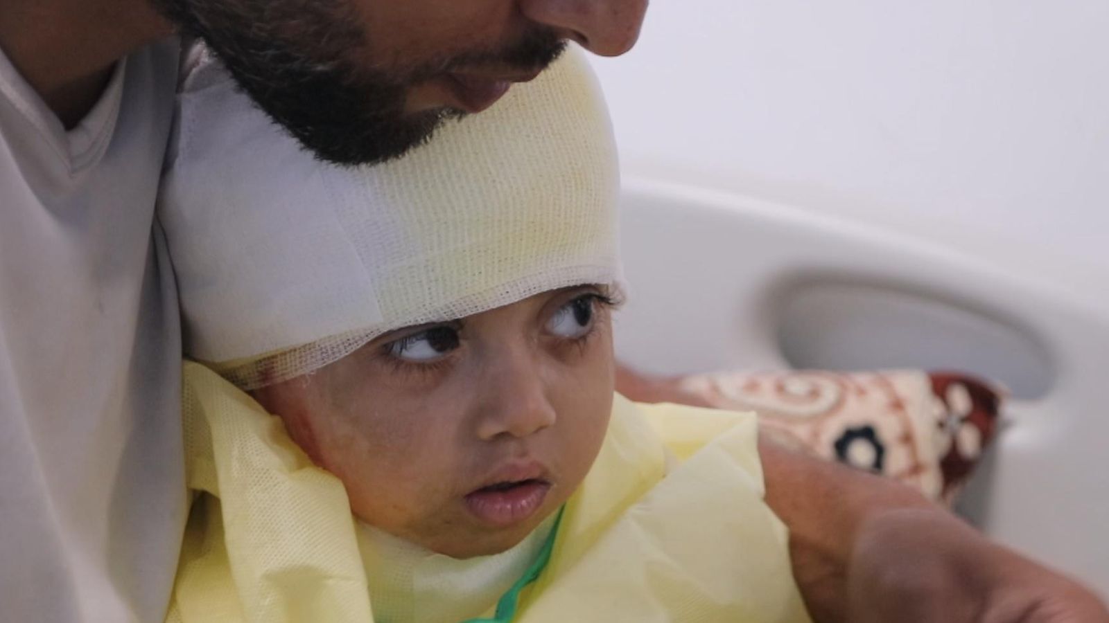 UK urged to admit 11 Gaza children hurt in the war for urgent treatment