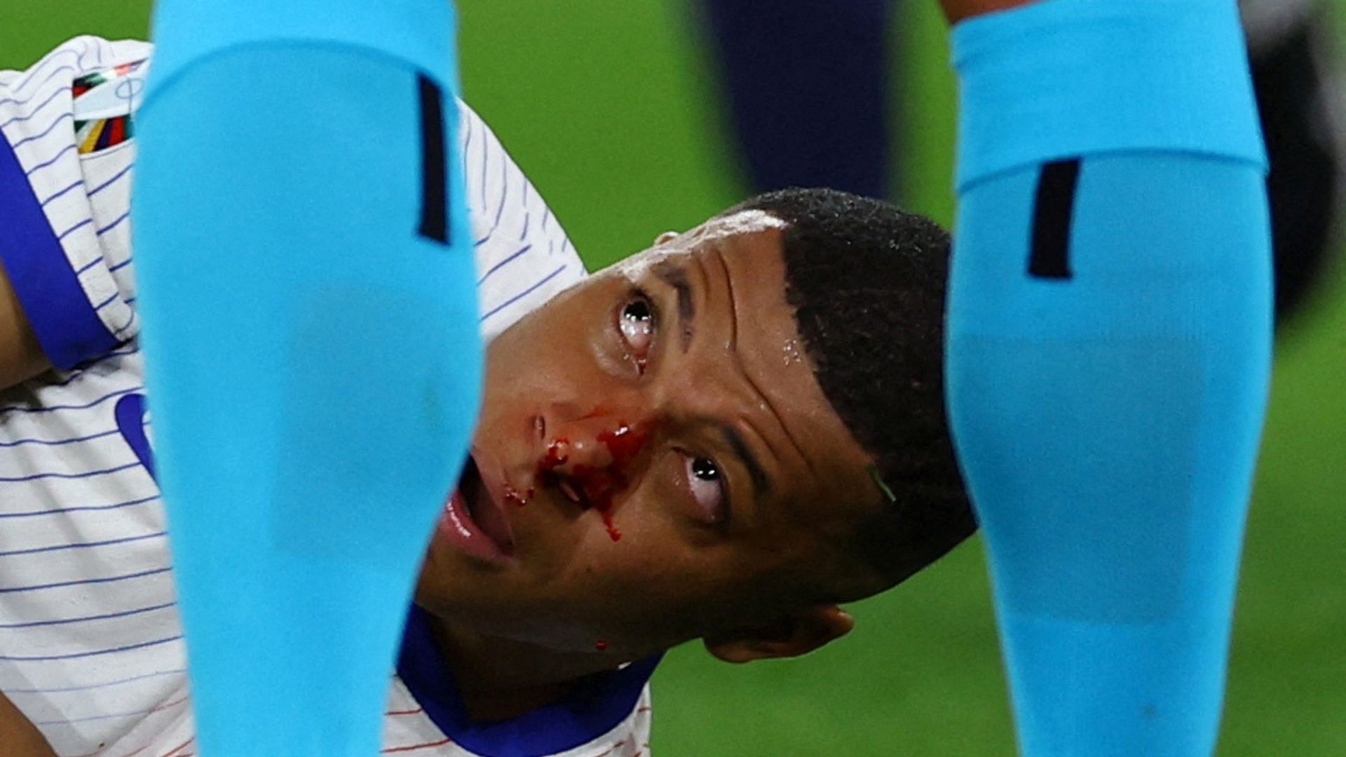 'Very bad news' for France at Euros as star player suffers broken nose