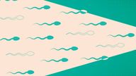 Illustration of sperm for story on male birth control. Pic: filo/iStock