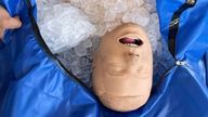 Cold water immersion therapy is being used by Phoenix firefighters on heatstroke victims. Pic: AP