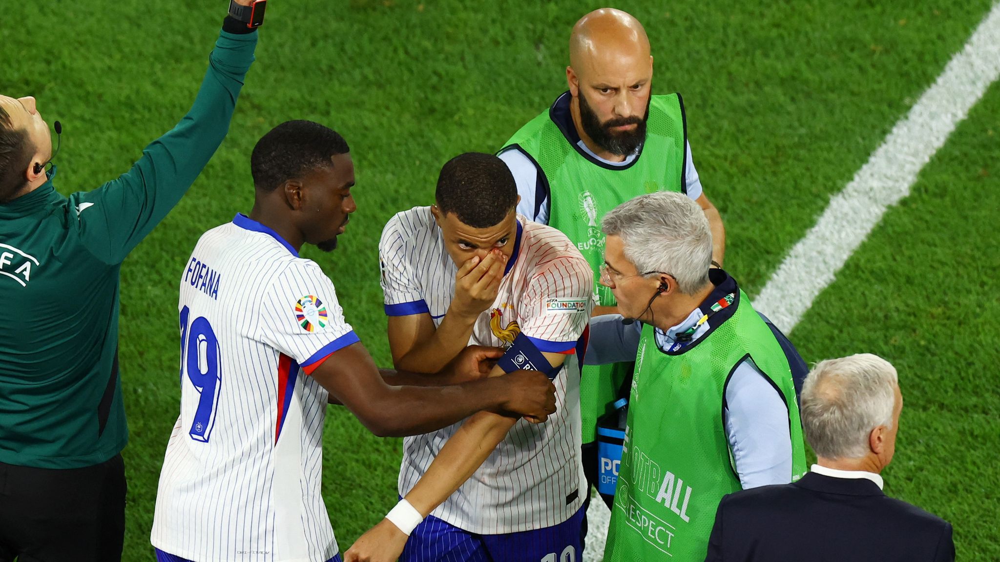 Euro 2024 France Captain Kylian Mbappe Suffers Broken Nose During Victory Opener Against 1600