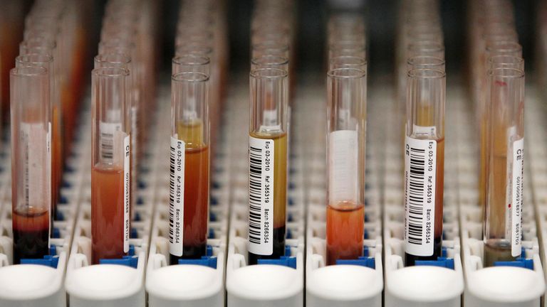 Blood samples waiting for genetic testing in Manchester. Pic: Reuters