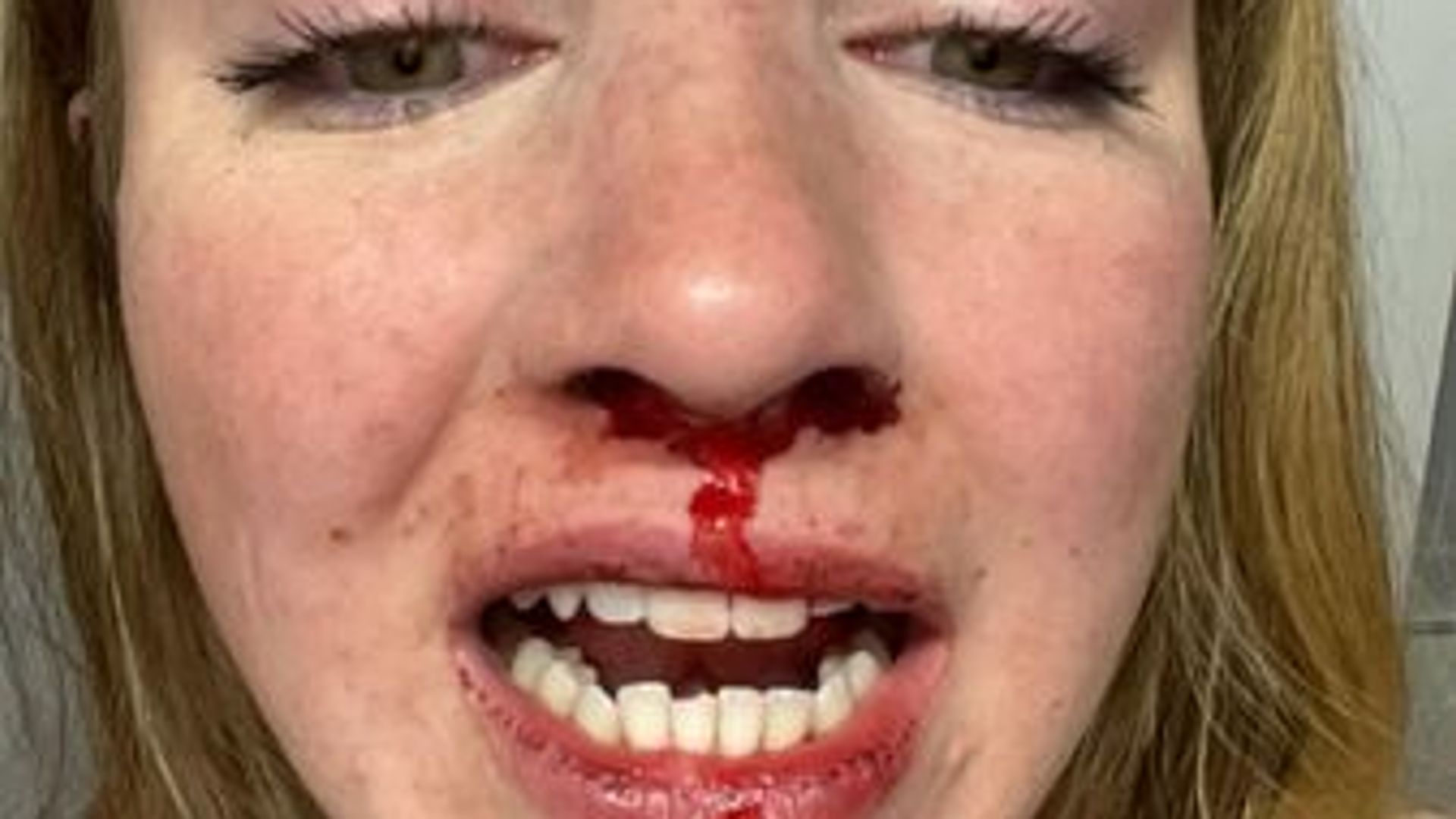 Woman 'terrified' to return to area after 'homophobic' attack by group of men