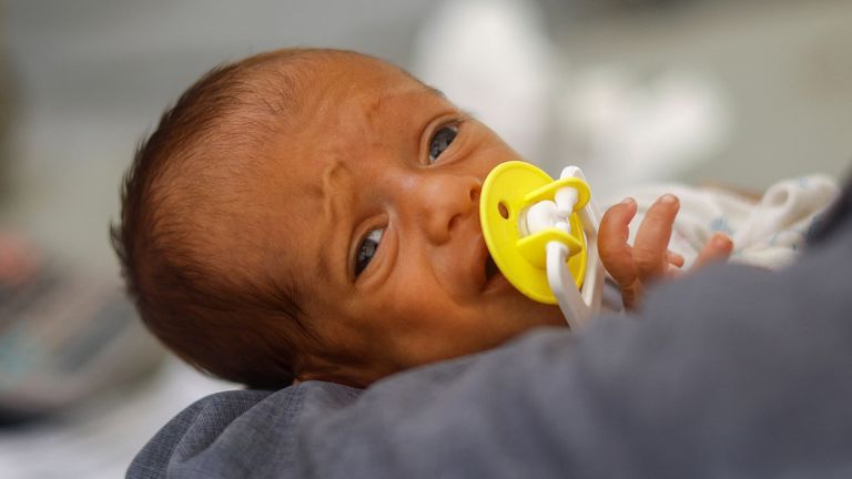 A malnourished Palestinian baby is held while receiving treatment at the International Medical Corps field hospital, amid the Israel-Hamas conflict, in Deir Al-Balah in the southern Gaza Strip, June 22, 2024. REUTERS/Mohammed Salem