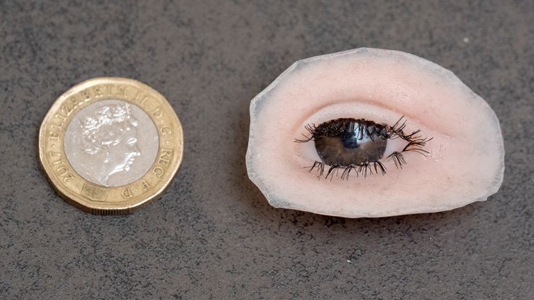 Nuala's prosthetic eye.  Photo: PA