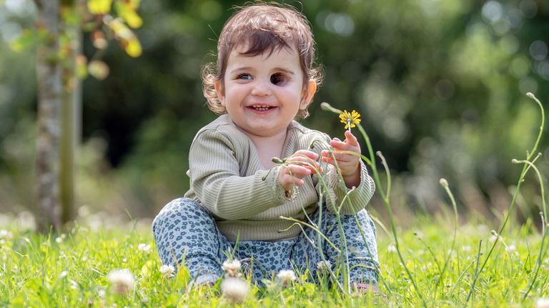 Nuala was diagnosed with a rare soft tissue tumour when she was just 10 months old. Pic: PA