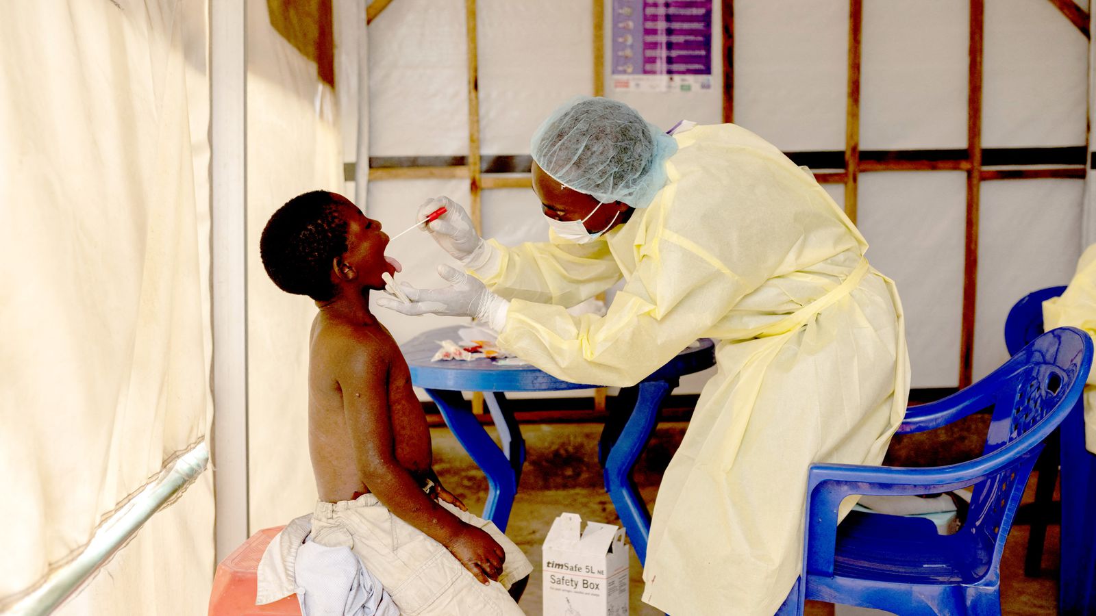 New case of Clade lb mpox detected in England | UK News | Sky News