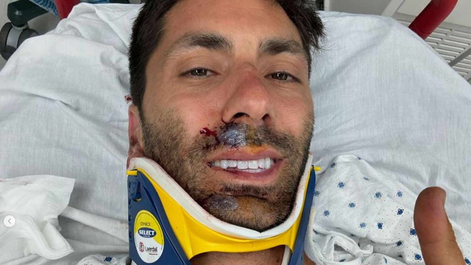 Catfish star breaks neck