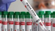 FILE PHOTO: A test tube labelled "Mpox virus positive" is held in this illustration taken August 20, 2024. REUTERS/Dado Ruvic/Illustration/File Photo