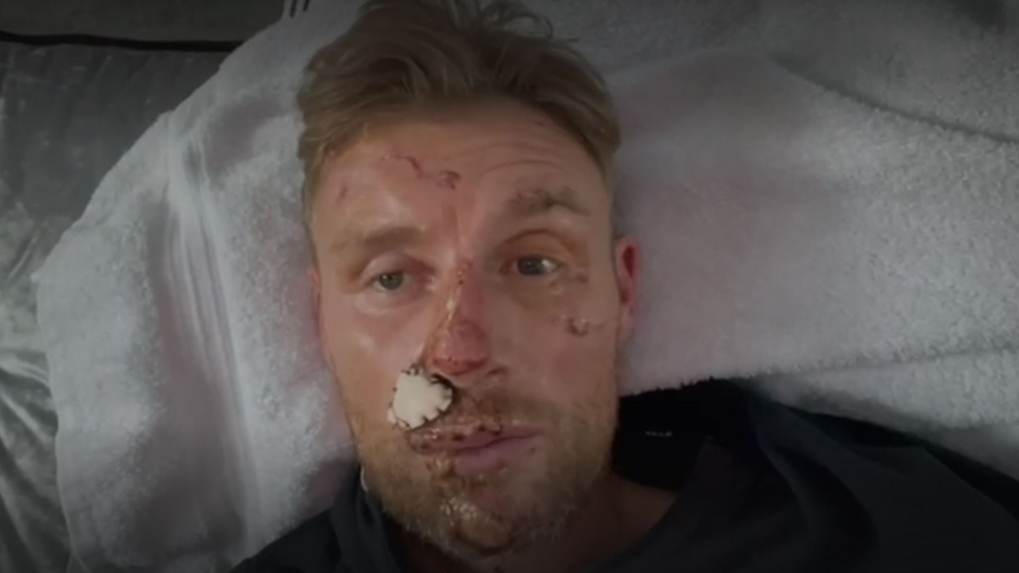 Freddie Flintoff Reveals Extent Of Injuries After Top Gear Crash | Ents ...