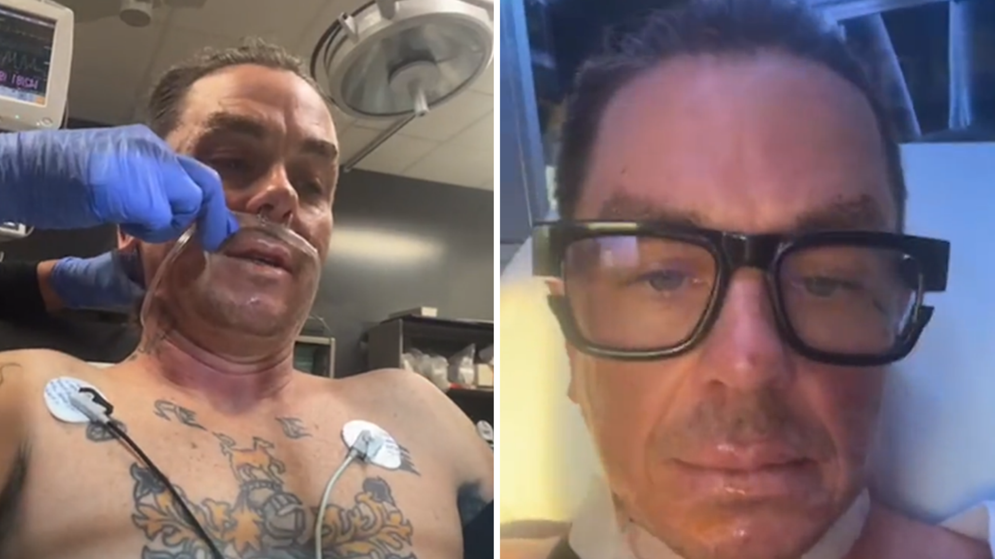 Slipknot's Sid Wilson in hospital with 'serious burns' after bonfire ...