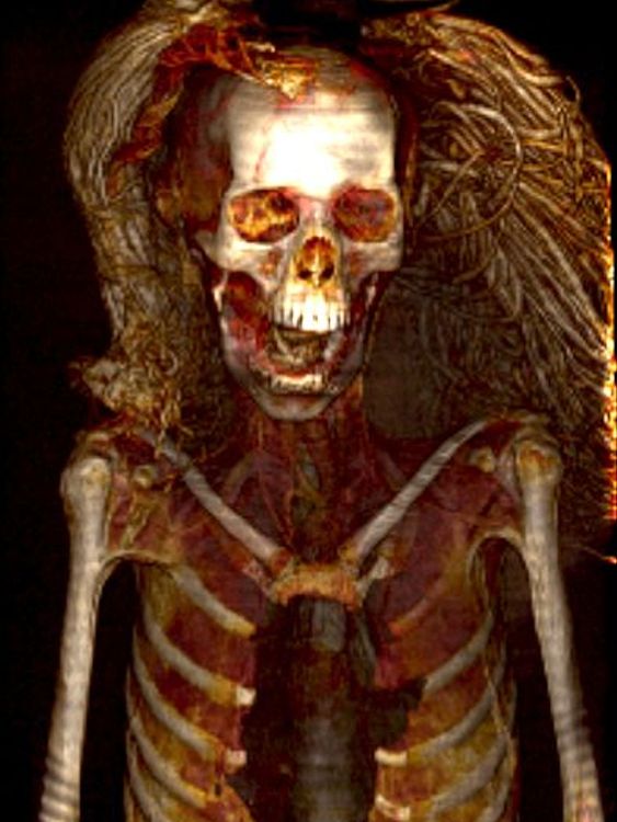 A scan of the ancient Egyptian mummy known as the Screaming Woman showing her wig