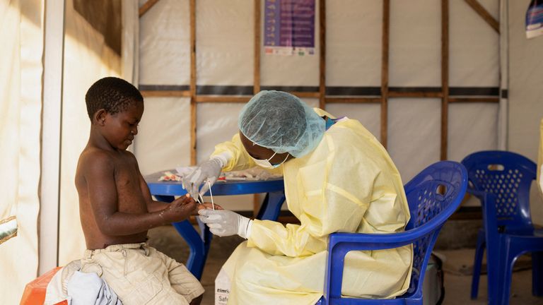 Christian Musema, a laboratory nurse, takes a sample from a child declared a suspected case Mpox - an infectious disease caused by the monkeypox virus that sparks off a painful rash, enlarged lymph nodes and fever; at the the treatment centre in Munigi, Pic: Reuters