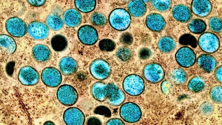 Mpox virus particles shown in a laboratory photo. Pic: NIAID handout via Reuters