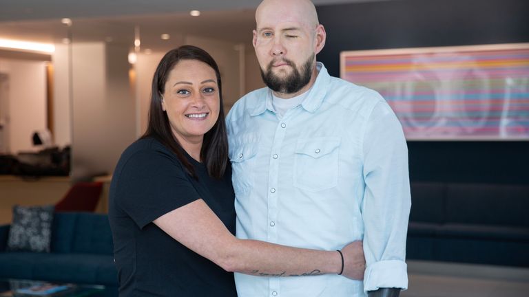 Aaron James and wife Meagan.
Pic: Haley Riccardi/NYU Langone Health/PA 