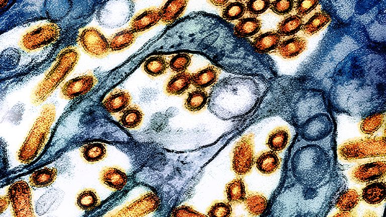 This colorized electron microscope image provided by the National Institute of Allergy and Infectious Diseases in 2024 shows avian influenza A virus (bird flu) particles, red/yellow, grown in cultured cells. (CDC, NIAID via AP)