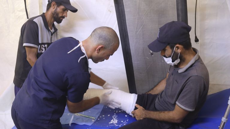 Amputees can be fitted with a new limb in a remarkably quick time