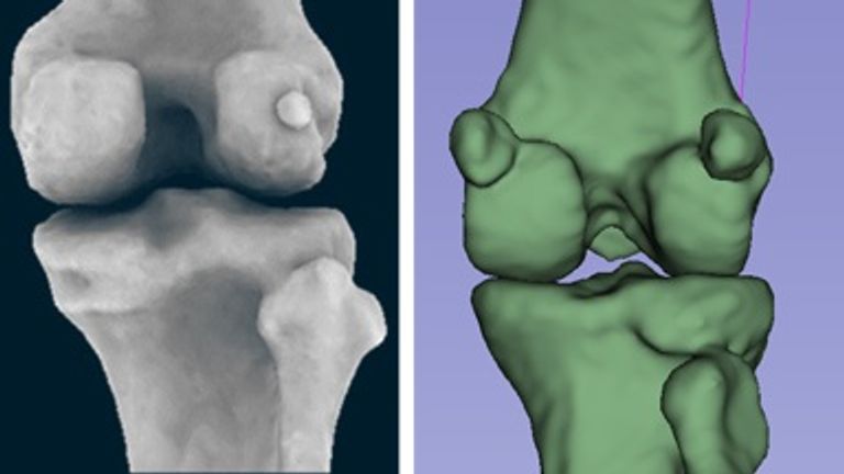 The lateral fabella of a human (left) and the medial and lateral fabella of a macaque (right). Pic: PA/King's College London 