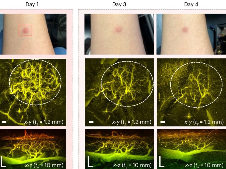 New miniature scanner could revolutionise diagnosis of diseases like cancer, diabetes and arthritis