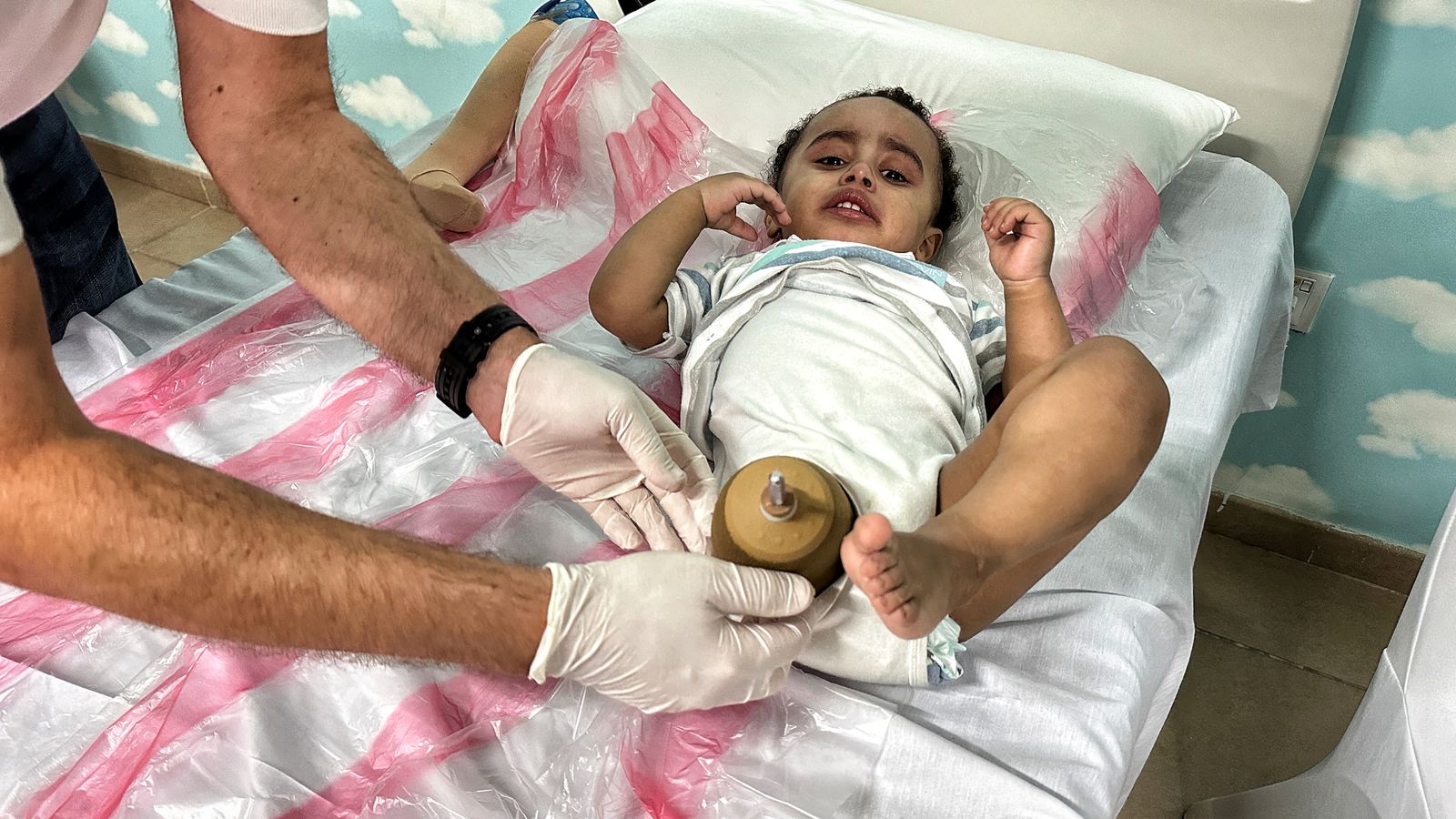 'The doctor told me count to three - and he cut my leg': The generation of Palestinian children with devastating amputations after a year of war