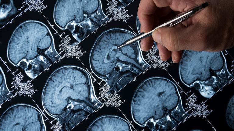 Pic: iStock