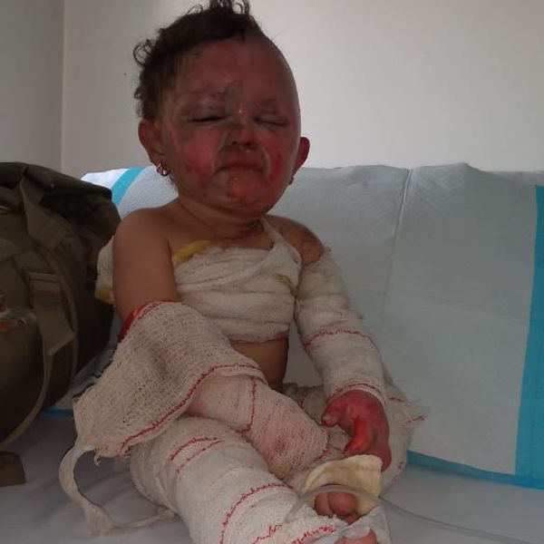 One-year-old Ivana Skayki was injured in an Israeli air strike on her hometown in southern Lebanon
