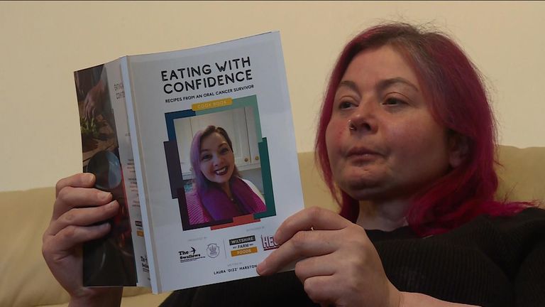 Foodie describes life without a tongue - as mouth cancer diagnoses hit record high