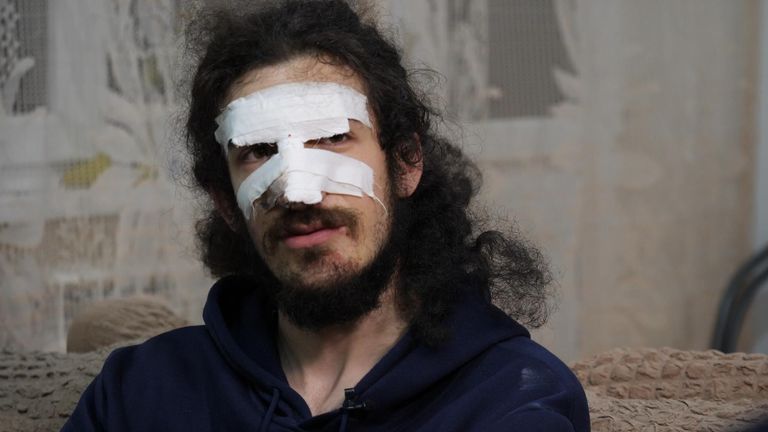 Zviad Maisashvili who was kicked in the head by a police officer