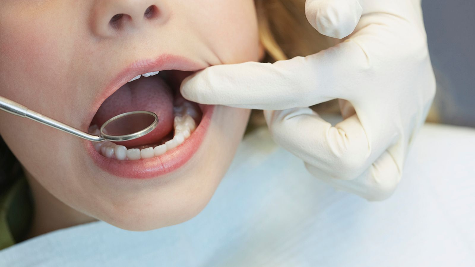 Dentists say extra NHS appointments will still leave 1.5 million untreated