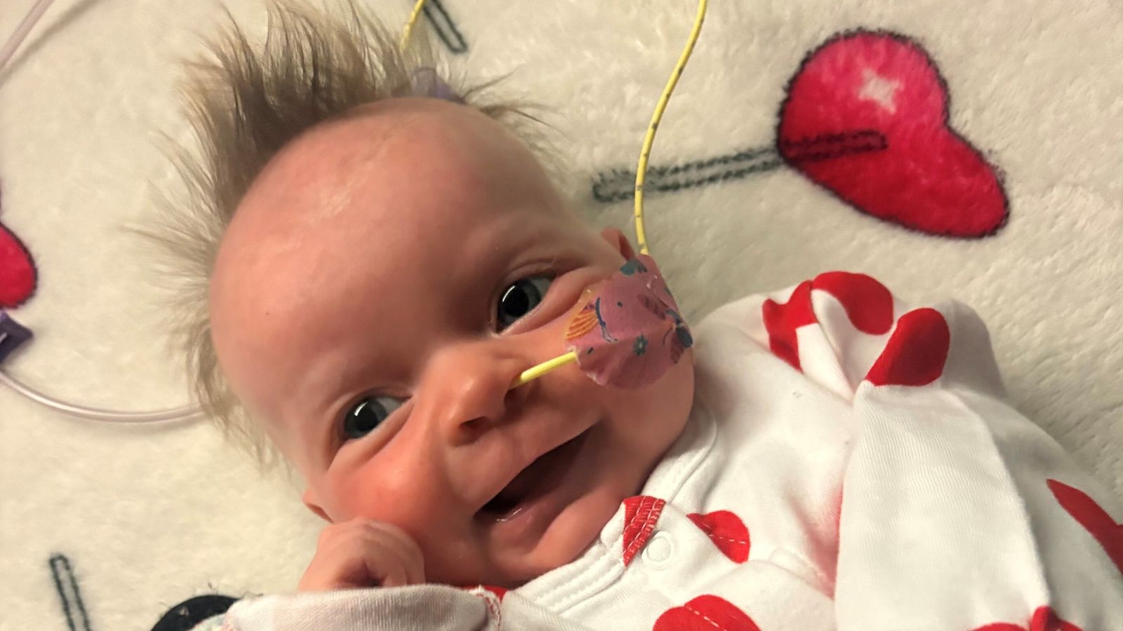 Mum of baby with rare blood disorder HLH urges people to sign stem cell register in bid to save daughter's life