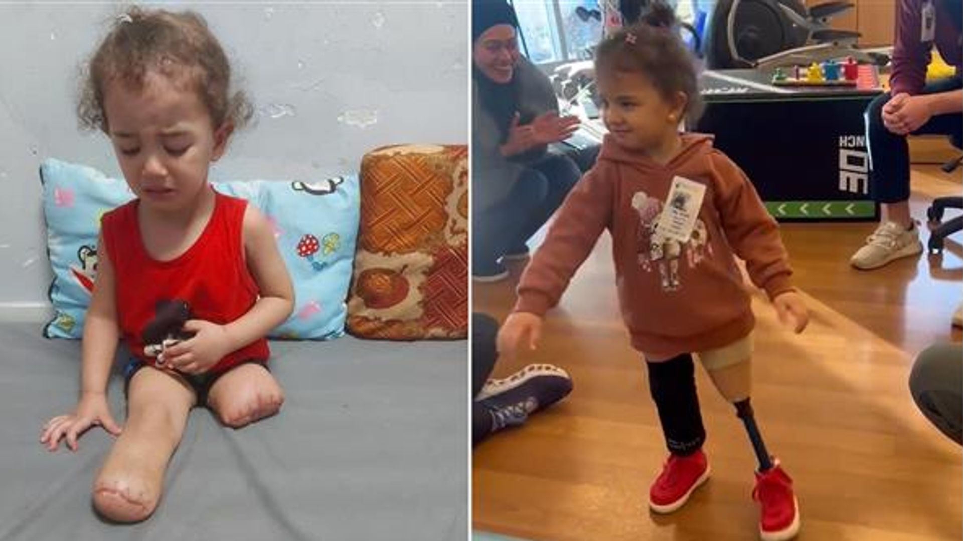 Gazan girl, 3,  who lost both legs under Israeli bombardment walks again