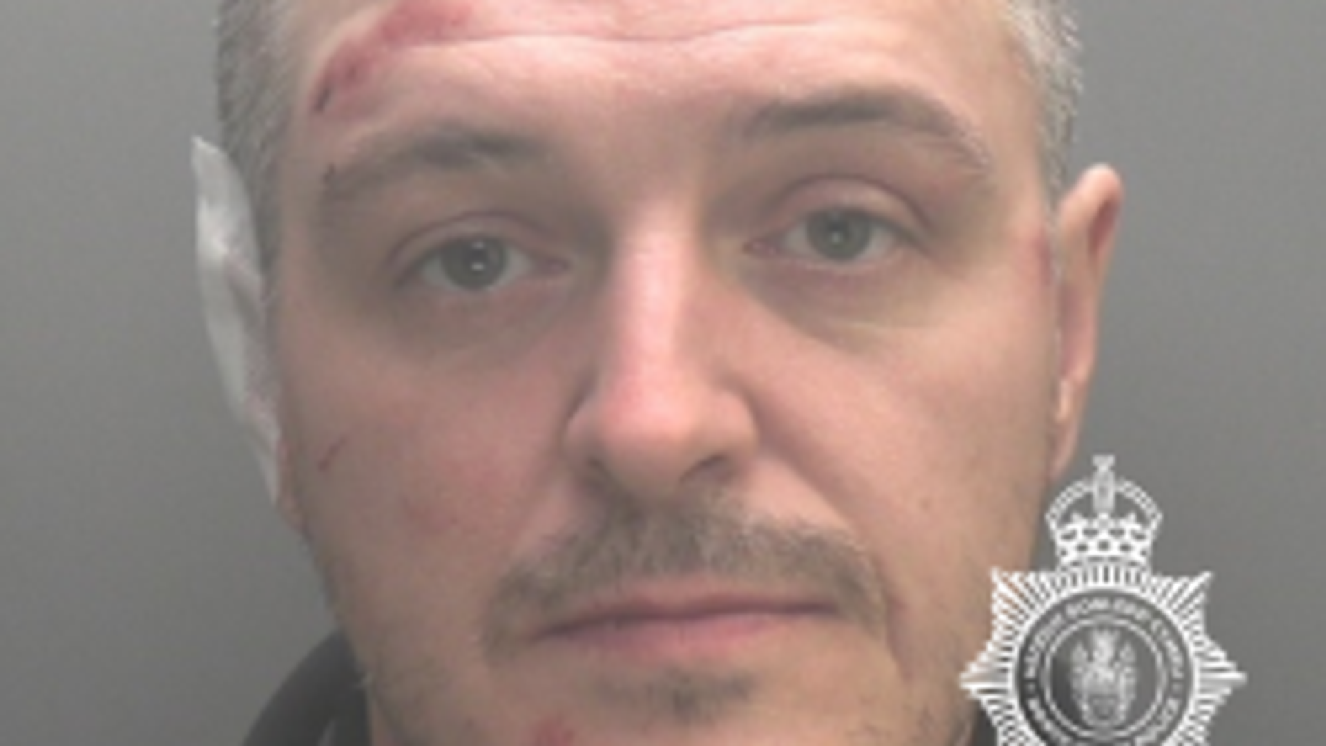 Man who bit off part of police officer's ear jailed