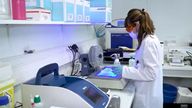 Doctors have begun the first global study of why some people with cancer beat the odds and survive so much longer than expected. UK arm of the study is at Cambridge University Hospitals NHS Trust. Picture from Thomas Moore package. Uploaded 27 January 2025