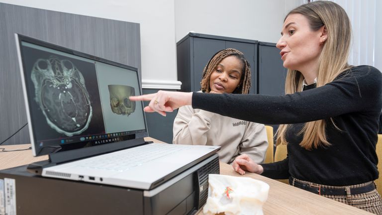 EMBARGOED TO 0001 MONDAY JANUARY 20....(Left to right) patient Ruvimbo Kaviya and Biomedical Engineer Lisa Ferrie look at and MRI scan and 3D digital model of Ruvimbo's tumour, after Ruvimbo became the first person in the UK to receive groundbreaking surgery to remove a tumour through her eye socket. Picture date: Thursday January 16, 2025. PA Photo. Surgeons at Leeds Teaching Hospitals NHS Trust have performed a groundbreaking procedure that marks a significant advancement in skull base tumour treatment. Ruvimbo Kaviya, aged 40, became the first person in the UK to have a tumour removed using a flexible tube and camera called an endoscope through her eye socket, after being diagnosed with meningiomas on the right side of the back of her brain and left side of her eye. See PA story HEALTH Keyhole. Photo credit should read: Danny Lawson/PA Wire                           